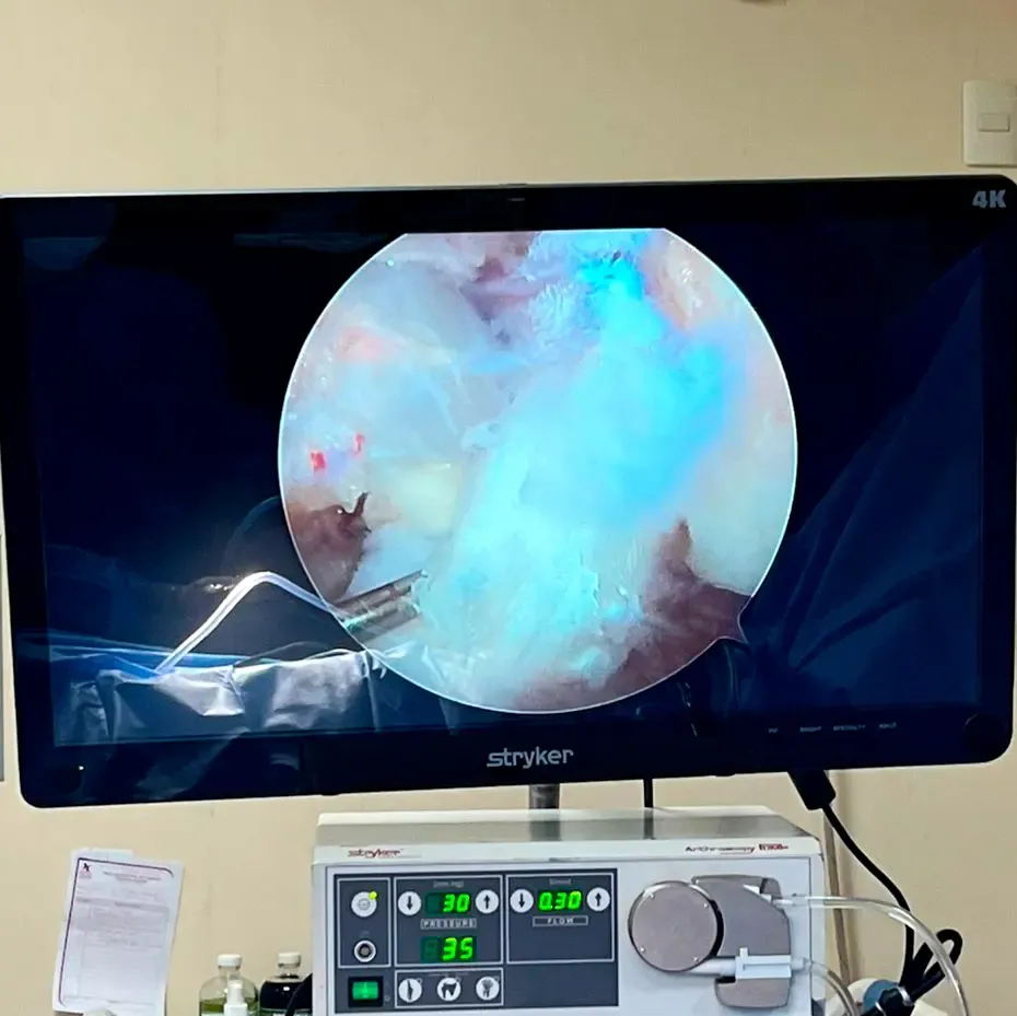 Reconstrucción del ligamento cruzado anterior